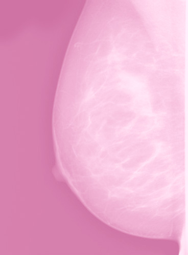 rosa-bandet